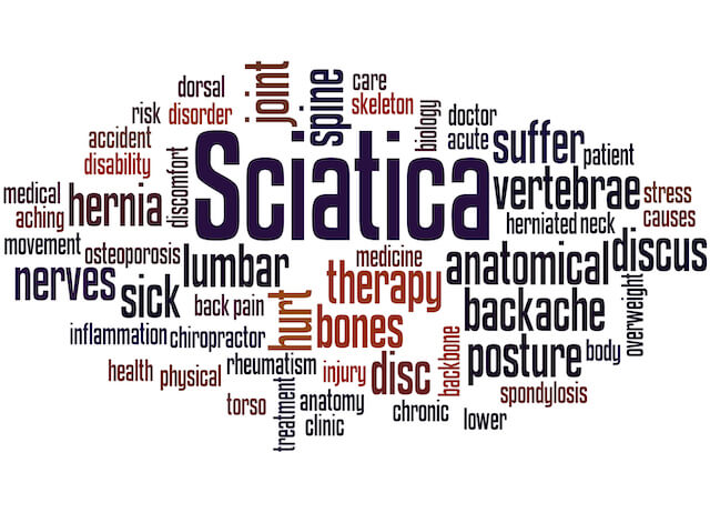 What REALLY is Sciatica?