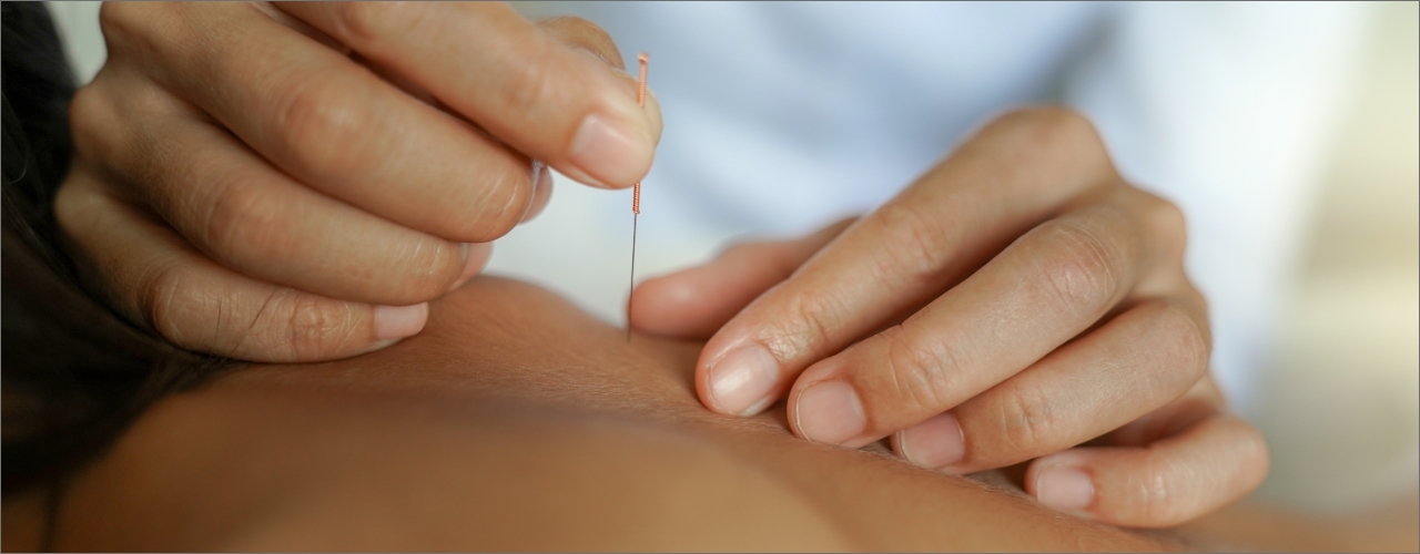 physical-therapy-clinic-dry-needling-comprehensive-physical-therapy-mandeville-la